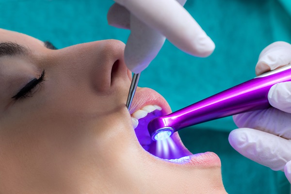 How A Dental Filling Can Protect Your Teeth