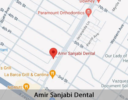 Map image for Options for Replacing Missing Teeth in Downey, CA